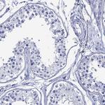 DPP4 Antibody in Immunohistochemistry (Paraffin) (IHC (P))