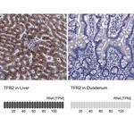 TFR2 Antibody in Immunohistochemistry (Paraffin) (IHC (P))