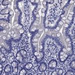 TFR2 Antibody in Immunohistochemistry (Paraffin) (IHC (P))