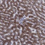 TFR2 Antibody in Immunohistochemistry (Paraffin) (IHC (P))