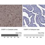 CNDP1 Antibody in Immunohistochemistry (Paraffin) (IHC (P))