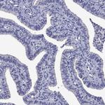 CNDP1 Antibody in Immunohistochemistry (Paraffin) (IHC (P))