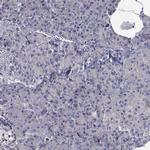 DOCK8 Antibody in Immunohistochemistry (Paraffin) (IHC (P))