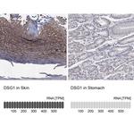 Desmoglein 1 Antibody in Immunohistochemistry (Paraffin) (IHC (P))