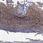 Desmoglein 1 Antibody in Immunohistochemistry (Paraffin) (IHC (P))