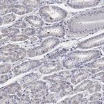 Desmoglein 1 Antibody in Immunohistochemistry (Paraffin) (IHC (P))