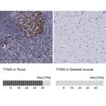 Thymidylate Synthase Antibody in Immunohistochemistry (Paraffin) (IHC (P))