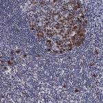 Thymidylate Synthase Antibody in Immunohistochemistry (Paraffin) (IHC (P))