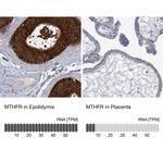 MTHFR Antibody in Immunohistochemistry (Paraffin) (IHC (P))