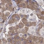 MTHFR Antibody in Immunohistochemistry (Paraffin) (IHC (P))