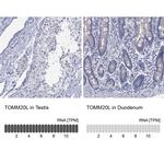 TOMM20L Antibody in Immunohistochemistry (Paraffin) (IHC (P))