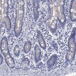 TOMM20L Antibody in Immunohistochemistry (Paraffin) (IHC (P))