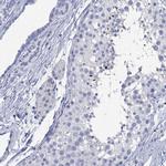 TOMM20L Antibody in Immunohistochemistry (Paraffin) (IHC (P))