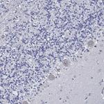 USP29 Antibody in Immunohistochemistry (Paraffin) (IHC (P))