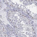 USP29 Antibody in Immunohistochemistry (Paraffin) (IHC (P))