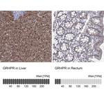 GRHPR Antibody in Immunohistochemistry (Paraffin) (IHC (P))