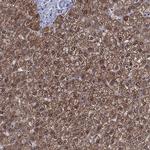 GRHPR Antibody in Immunohistochemistry (Paraffin) (IHC (P))