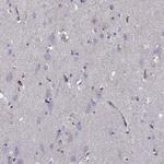 SHMT1 Antibody in Immunohistochemistry (Paraffin) (IHC (P))