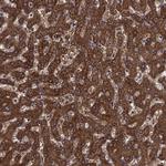 SHMT1 Antibody in Immunohistochemistry (Paraffin) (IHC (P))