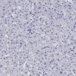 MC2R Antibody in Immunohistochemistry (Paraffin) (IHC (P))