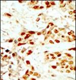 DAPK2 Antibody in Immunohistochemistry (Paraffin) (IHC (P))