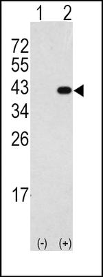 DAPK2 Antibody in Western Blot (WB)