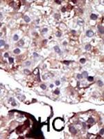 SPHK2 Antibody in Immunohistochemistry (Paraffin) (IHC (P))