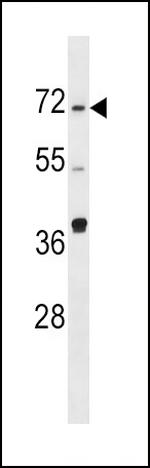 SPHK2 Antibody in Western Blot (WB)