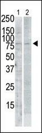 PLK2 Antibody in Western Blot (WB)