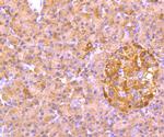 ALDH1A1 Antibody in Immunohistochemistry (Paraffin) (IHC (P))