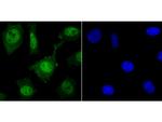 HDAC2 Antibody in Immunocytochemistry (ICC/IF)