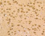 HDAC2 Antibody in Immunohistochemistry (Paraffin) (IHC (P))