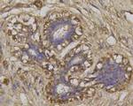 Beclin 1 Antibody in Immunohistochemistry (Paraffin) (IHC (P))