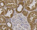 Beclin 1 Antibody in Immunohistochemistry (Paraffin) (IHC (P))