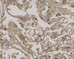 Beclin 1 Antibody in Immunohistochemistry (Paraffin) (IHC (P))