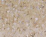 Beclin 1 Antibody in Immunohistochemistry (Paraffin) (IHC (P))