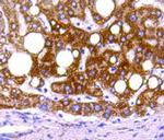 Prohibitin Antibody in Immunohistochemistry (Paraffin) (IHC (P))