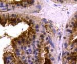 MCL-1 Antibody in Immunohistochemistry (Paraffin) (IHC (P))