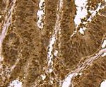 SMAD3 Antibody in Immunohistochemistry (Paraffin) (IHC (P))