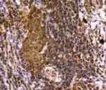 SMAD3 Antibody in Immunohistochemistry (Paraffin) (IHC (P))