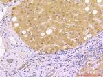 Beclin 1 Antibody in Immunohistochemistry (Paraffin) (IHC (P))