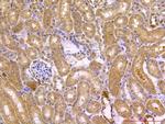 Beclin 1 Antibody in Immunohistochemistry (Paraffin) (IHC (P))