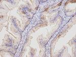 MAL Antibody in Immunohistochemistry (Paraffin) (IHC (P))