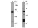 SQSTM1 Antibody in Western Blot (WB)