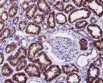 JNK1 Antibody in Immunohistochemistry (Paraffin) (IHC (P))