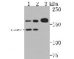 P-Glycoprotein Antibody in Western Blot (WB)