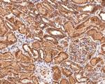 TIMM23 Antibody in Immunohistochemistry (Paraffin) (IHC (P))