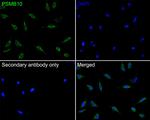 PSMB10 Antibody in Immunocytochemistry (ICC/IF)