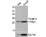 PSMB10 Antibody in Western Blot (WB)