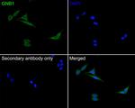 GNB1 Antibody in Immunocytochemistry (ICC/IF)